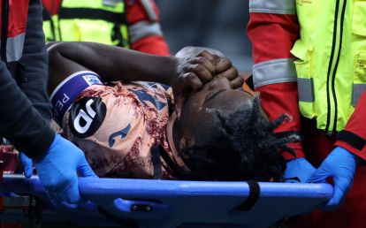 epa11644324 Torinos Duvan Zapata is stretchered off the pitch during the Italian Serie A soccer match between FC Inter and Torino FC at Giuseppe Meazza stadium in Milan, Italy, 05 October 2024. EPA-EFE/MATTEO BAZZI