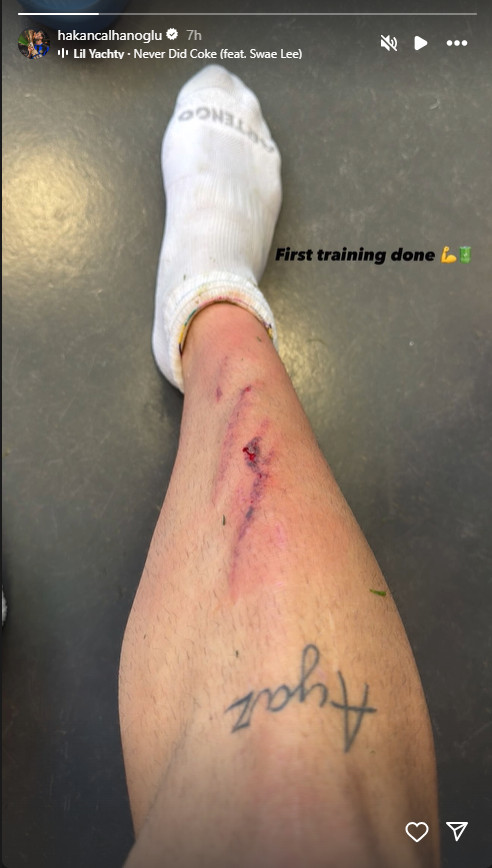 Hakan Calhanoglu entraîne l'Inter IG